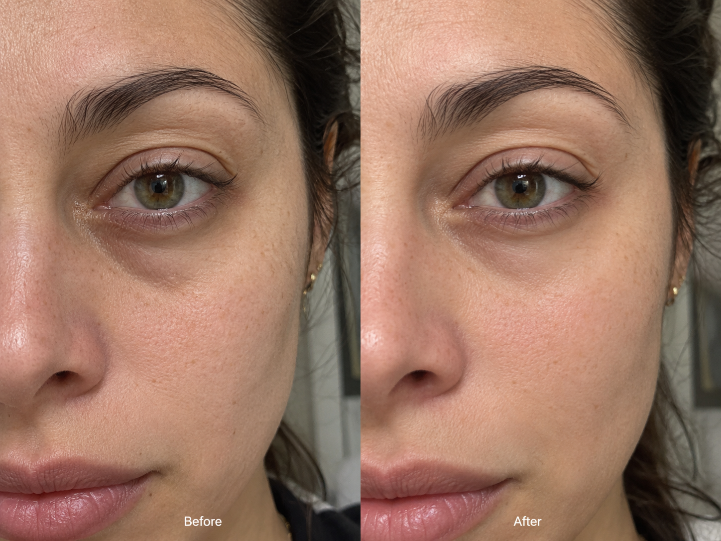 Close-up of the eye area before and after four weeks of use